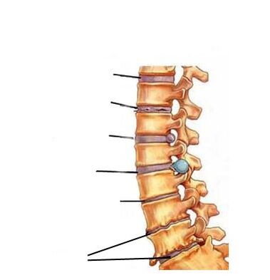Etape de dezvoltare a osteochondrozei