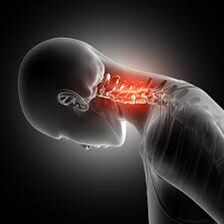 Osteochondroza cervicală