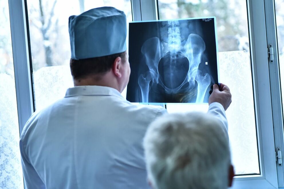 Doctorul se uită la o imagine a articulației șoldului cu artroză